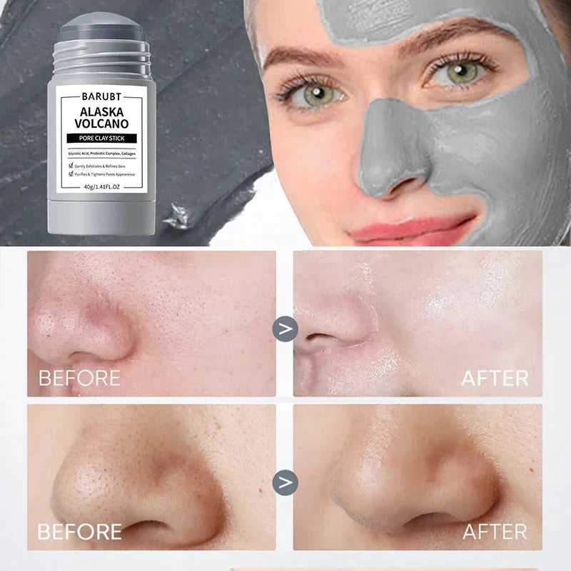 Volcano Deep Clean Mask Stick